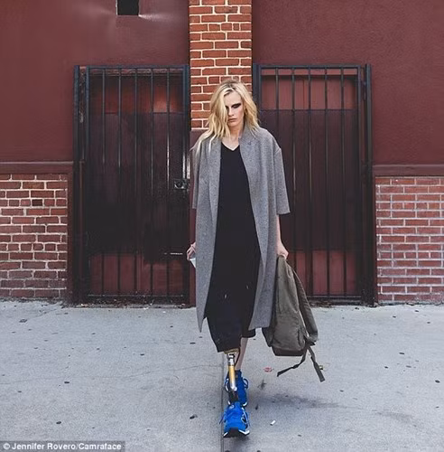 Cô thường xuyên đăng ảnh về các sự kiện hàng ngày hoặc bản thân bao gồm cả chiếc chân giả lên Instagram.