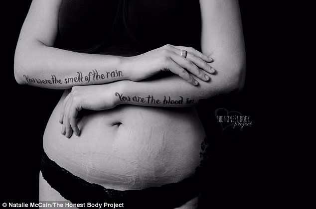 Nhiếp ảnh gia chia sẻ, mỗi bức ảnh đều làm nổi bật cơ thể của những người phụ nữ kém may mắn này, giúp họ lấy lại tự tin và sức mạnh để sống lạc quan.