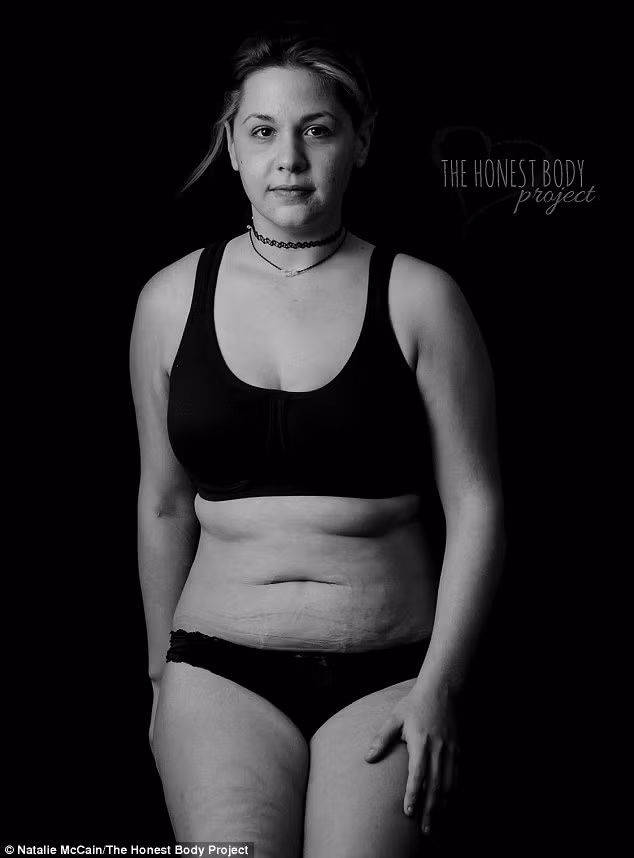 Loạt ảnh đen trắng có tựa đề là The True Faces of Depression chụp lại những phụ nữ bị rối loạn stress sau chấn thương do bị tấn công tình dục, trầm cảm sau sinh. Đây là một phần của sự án The Honest Body Project - dự án những hình ảnh trung thực của cơ thể phụ nữ sau sinh.