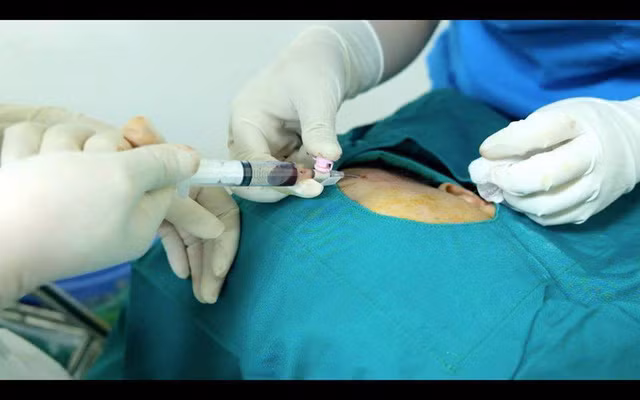 Don thai duong o co so khong phep, nguoi dan ong cap cuu trong dem-Hinh-2