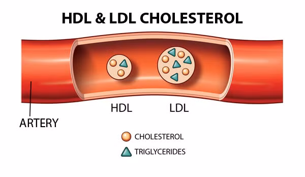 can cu do luong cholesterol trong mau
