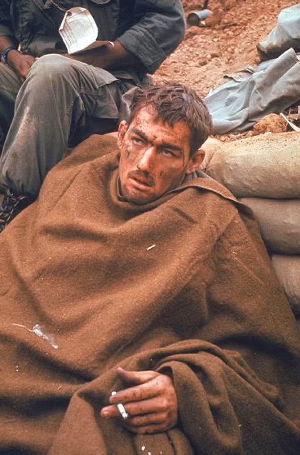Vẻ mặt mệt mỏi của một thương binh Mỹ trên chiến trường Khe Sanh. Ảnh: Larry Burrows.