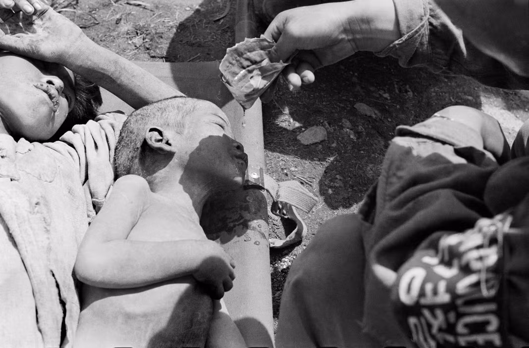 Điều kiện sống thiếu thốn khiến tình trạng bệnh tật và suy dinh dưỡng xảy ra phổ biến ở làng San Jang Ri. Ảnh: Werner Bischof.