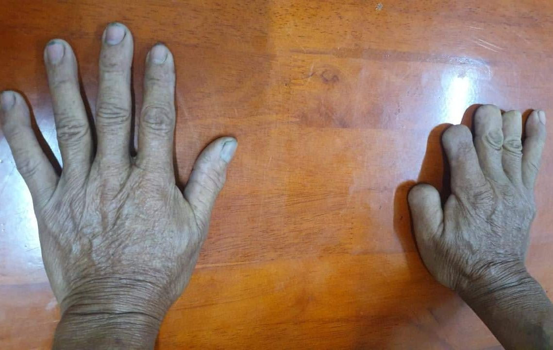 Một ngày đầu tháng 1, tổ trinh sát Cơ quan Cảnh sát điều tra (Công an tỉnh Quảng Ngãi) xuất hiện tại căn nhà nhỏ ở huyện Cái Nước (tỉnh Cà Mau). Chủ nhà là một người đàn ông có bàn tay với 4 ngón cụt nhiều đốt. Tại cơ quan công an, với đặc điểm nhận dạng bàn tay cụt ngón và nhiều thông tin liên quan khác trong vụ án, gã đàn ông 71 tuổi đã cúi đầu nhận tội. Ông ta chính là Phan Thanh Việt, kẻ tham gia giết 6 người cướp tài sản từ 43 năm trước. 