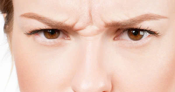 Nếp nhăn sống mũi là các nếp nhăn nhỏ xuất hiện ở ngang sống mũi khi cười, nhăn mặt, hoặc có các biểu cảm khuôn mặt. Ảnh minh họa