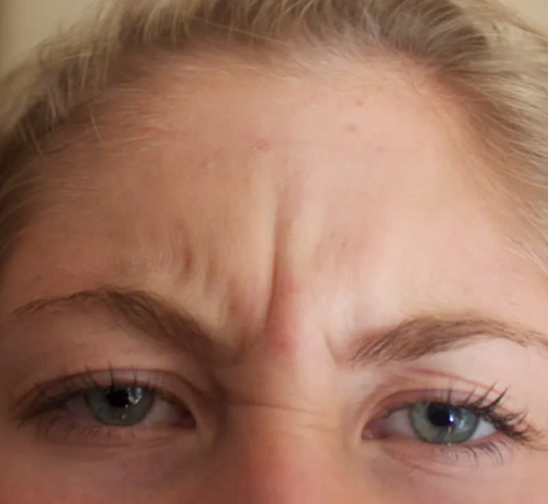 Mặc dù nếp nhăn mũi là một phần không thể tránh khỏi của quá trình lão hóa, nhưng việc thực hiện một số biện pháp phòng ngừa nhất định có thể làm chậm sự xuất hiện hoặc giảm thiểu mức độ nghiêm trọng. Ảnh minh họa