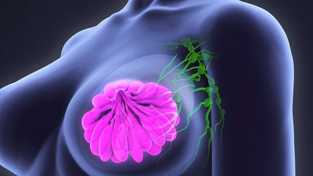 Lam gi khi nghi ngo co dau hieu ung thu vu?