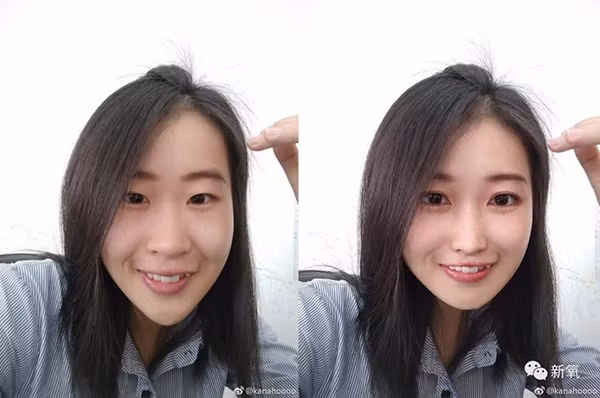 Mắt, mũi, cằm,... đều được chỉnh sửa.