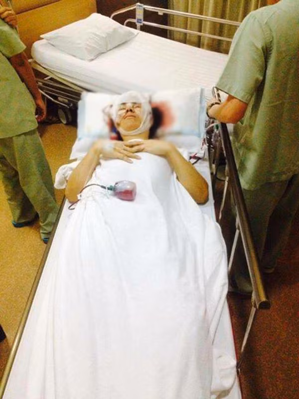 Bow trả qua những cuộc phẫu thuật nhiều đau đớn về thể xác, cho đến khi gương mặt hoàn thiện thì Bow và những người xung quanh vô cùng bất ngờ trước nhan sắc mới đầy cuốn hút.