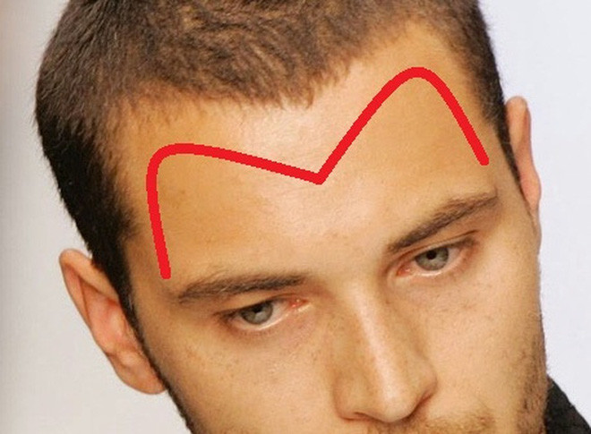 Họ có thể kiếm được nhiều của cải khi còn trẻ, nửa sau cuộc đời không lo cơm ăn áo mặc, vàng bạc đầy đủ, không lo không có tiền tiêu xài, không lo có tiền tiêu xài hoang phí. Đây là người có khả năng siêu hấp thụ vàng! 