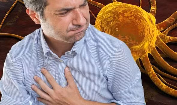 Canh bao 3 trieu chung cua ung thu giai doan 4