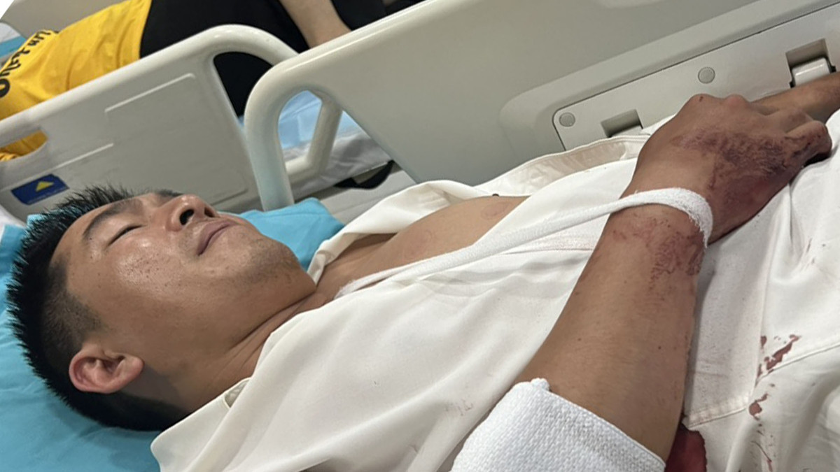 Một thẩm phán ở Lâm Đồng bị kẻ trộm chém bị thương Mot tham phan o Lam Dong bi ke trom chem bi thuong