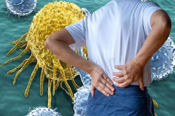 Triệu chứng phổ biến cảnh báo ung thư nhưng thường bị bỏ qua Trieu chung pho bien canh bao ung thu nhung thuong bi bo qua