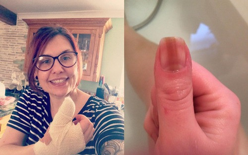 Duong chi do xuat hien o mong tay, nu y ta bang hoang phat hien su that