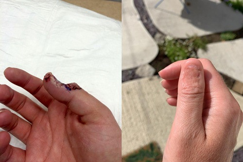 Duong chi do xuat hien o mong tay, nu y ta bang hoang phat hien su that-Hinh-2