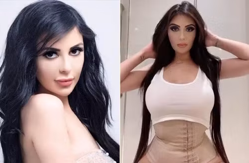 Chi tiền tỉ để thành Kim siêu vòng ba, cô gái suýt chết Chi tien ti de thanh Kim sieu vong ba, co gai suyt chet