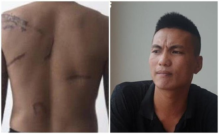 Khoi to vu con do chem nguoi, Duong “Nhue” dan xep cach day 8 nam