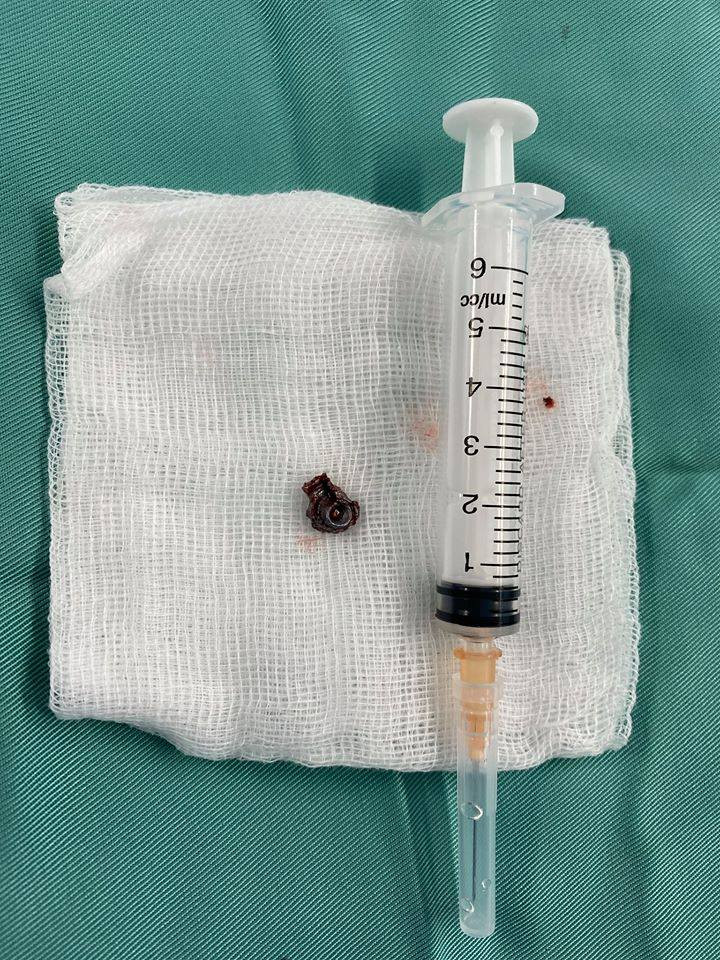 No sung tai quan tra cuc Hai Phong: Nan nhan bi thuong the nao?-Hinh-3