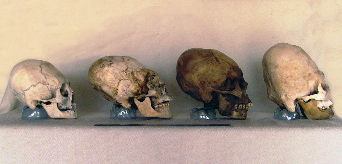 Các nhà khoa học suy đoán đột biết trên có thể là bằng chứng cho thấy người Paracas là một chủng sinh vật giống người nhưng hoàn toàn khác với những chủng người mà chúng ta biết đến như: Homo sapiens, Neanderthals hay Denisovans.