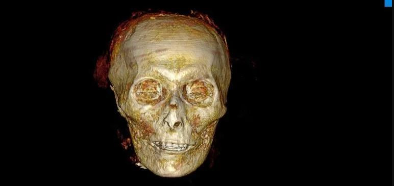 Kết quả chụp CT không tìm thấy bất kỳ vết thương nào hay biến dạng do bệnh tật gây ra. Từ đây, các chuyên gia vẫn chưa thể làm sáng tỏ nguyên nhân tử vong của pharaoh Amenhotep I.