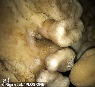 Altamura Man được cho là đã ngã xuống một hố sâu do không nhìn thấy nó. Sự cố này khiến ông tìm được lối thoát hoặc có người tới cứu giúp nên đã tử vong vì đói khát trong hố sâu.