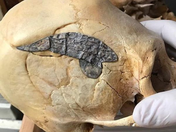 Theo đó, các chuyên gia nhận định hộp sọ gắn kim loại trên chính là bằng chứng quan trọng giúp chứng minh con người sống cách đây 2.000 năm có khả năng thực hiện các ca phẫu thuật khó.