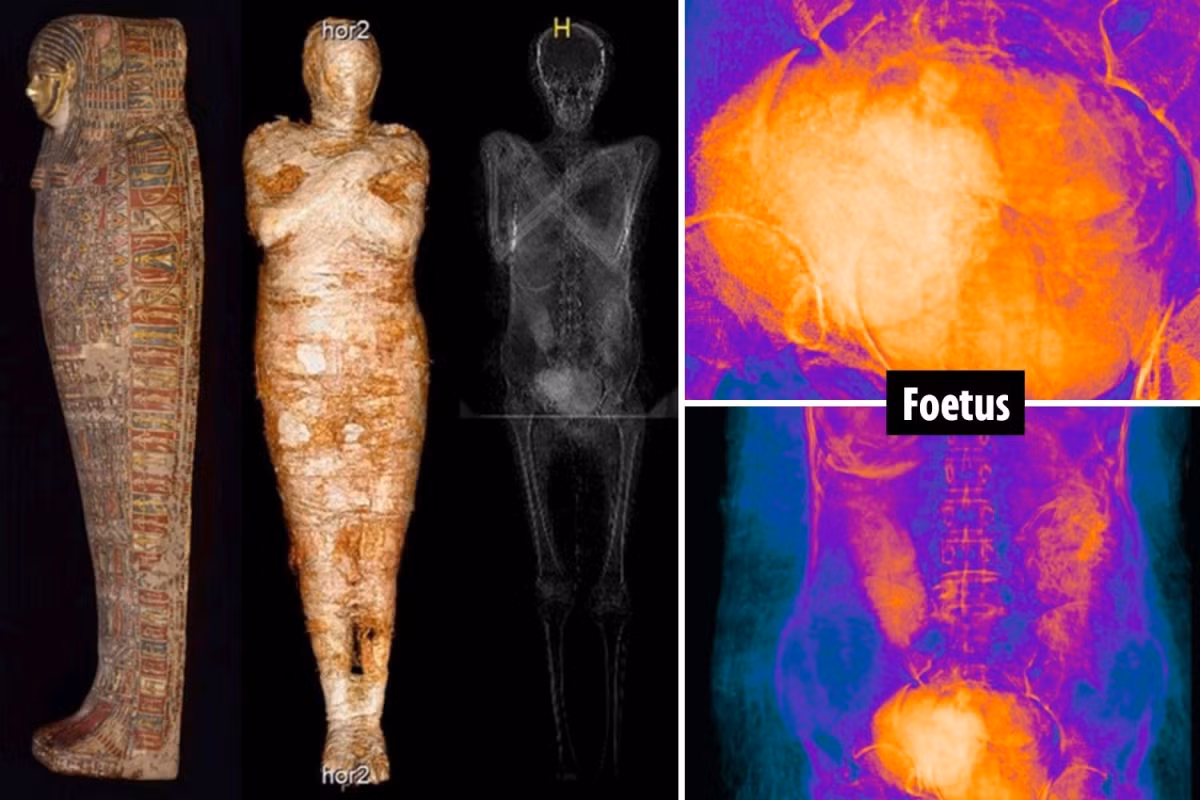 Các nhà nghiên cứu tin rằng việc phân tích các mô mềm được bảo quản của xác ướp có thể mang lại một số manh mối giúp tìm ra nguyên nhân tử vong của thai phụ.