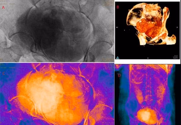 Kết quả cho thấy xác ướp không phải là của linh mục Hor-Djehuty. Thay vào đó, thi hài thuộc về một phụ nữ tử vong khi mang thai. Thai nhi đang ở tuần thai thứ 26 - 30.