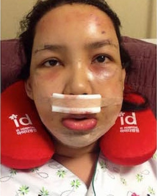 Cơ thể này sau đó gần như đã bị “đập đi xây mới”, tạo nên một con người hoàn toàn khác.