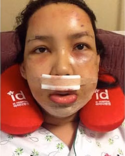 Cơ thể này sau đó gần như đã bị “đập đi xây mới”, tạo nên một con người hoàn toàn khác.