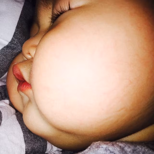 Hai má bánh bao của Jo Lee Soo là điểm khiến dân mạng "phát cuồng". Trên mạng Hàn Quốc, sau khi xem những hình ảnh của em bé mặt bánh bao, nhiều dân mạng đã phải thốt lên rằng họ "thèm khát" được một lần nựng, véo yêu đôi má của bé Jo Lee Soo.