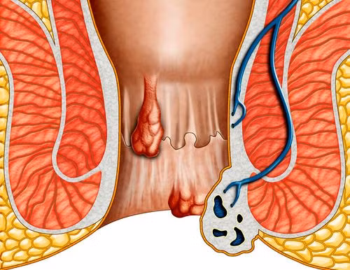 Chuyen ngang trai chong bi tri khien vo bi lanh cam