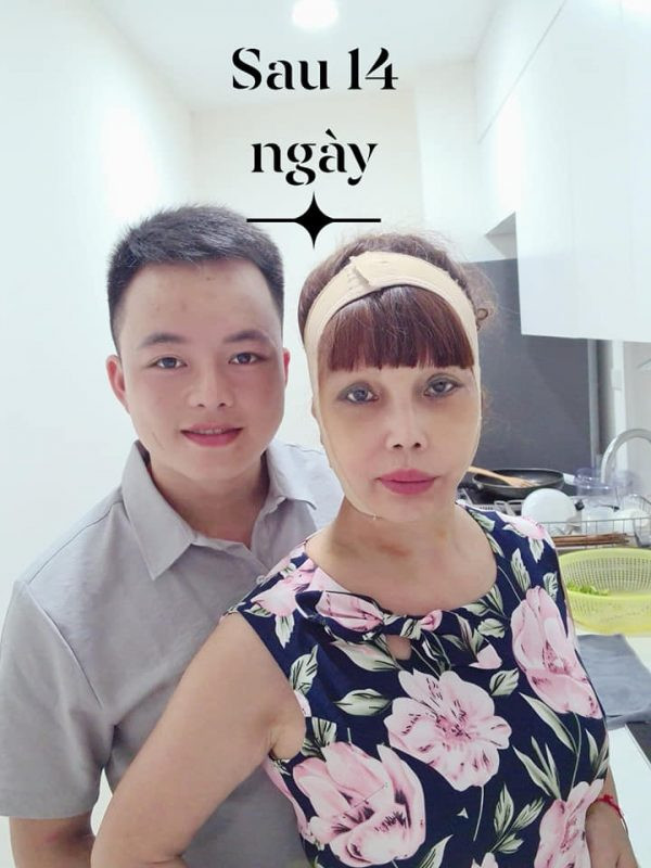 Sau 14 ngày từ cuộc đại thẩm mỹ thế nhưng gương mặt của cô vẫn không hề tiến triển gì hơn.