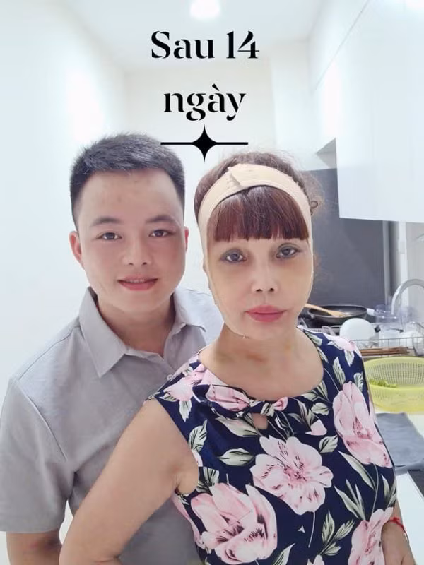 Sau 14 ngày từ cuộc đại thẩm mỹ thế nhưng gương mặt của cô vẫn không hề tiến triển gì hơn.