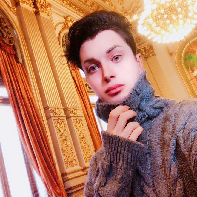 Trong tương lai, Luis muốn tiến hành thêm nhiều ca phẫu thuật, bao gồm căng da mặt. Nhiều bác sĩ đã từ chối yêu cầu này của anh. Nhưng gần đây, một bác sĩ thẩm mỹ ở thủ đô Buenos Aires, Argentina đã nhận lời. Bên cạnh đó, anh muốn phẫu thuật thu nhỏ yết hầu, tạo hình mắt mèo, thay đổi màu mắt bằng cách cấy ghép nội nhãn, trồng răng nanh…