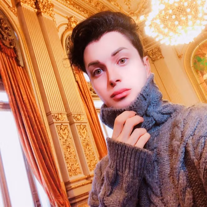 Trong tương lai, Luis muốn tiến hành thêm nhiều ca phẫu thuật, bao gồm căng da mặt. Nhiều bác sĩ đã từ chối yêu cầu này của anh. Nhưng gần đây, một bác sĩ thẩm mỹ ở thủ đô Buenos Aires, Argentina đã nhận lời. Bên cạnh đó, anh muốn phẫu thuật thu nhỏ yết hầu, tạo hình mắt mèo, thay đổi màu mắt bằng cách cấy ghép nội nhãn, trồng răng nanh…