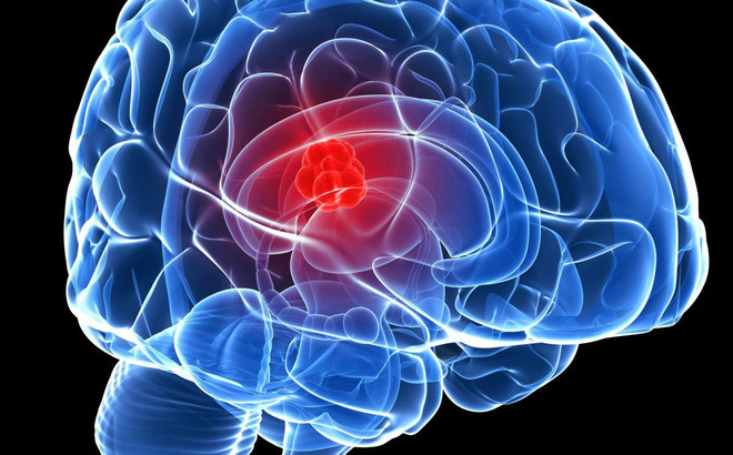 BS “quoc dan” Tran Quoc Khanh luu y cha me ve khoi u o tre nho