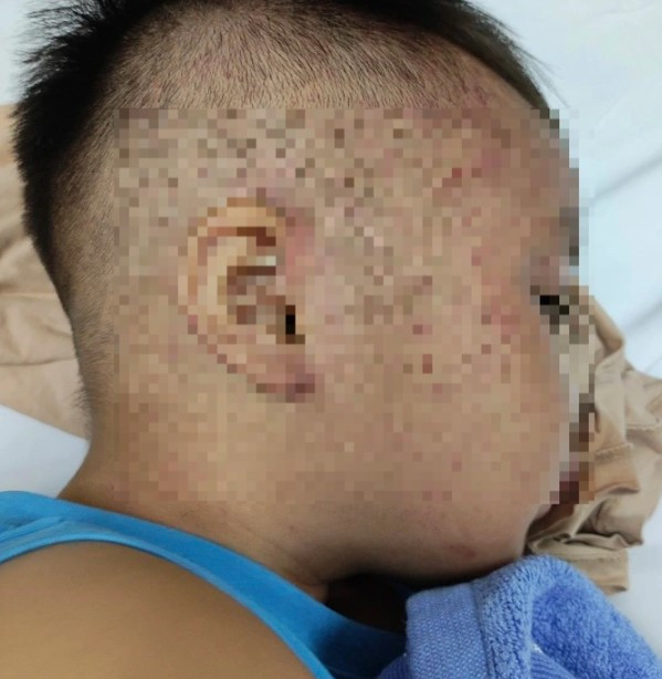 Cuu song be trai hon 3 tuoi nghi bi bao hanh, nhot trong tu dong