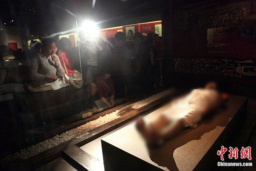 Thêm nữa, trong các tĩnh mạch có những cục máu đông. Đây là bằng chứng cho thấy nguyên nhân chính dẫn đến cái chết của Phu nhân Đại là đau tim. Bà cũng mắc một số căn bệnh khác như: sỏi mật, cholesterol cao, huyết áp cao và bệnh gan.