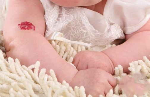 Theo giáo sư Tucker, ngay cả khi mọi người công nhận hiện tượng đầu thai chuyển kiếp có thật thì việc vết bớt chính là vết thương trên cơ thể ở kiếp trước rất khó lý giải.