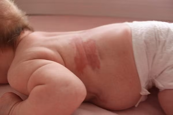 Trên thực tế, đa số trường hợp nhớ rõ cuộc sống kiếp trước là trẻ em. Khi còn nhỏ, các em có thể kể lại chi tiết cuộc sống ở kiếp trước nhưng khi lớn lên thì những ký ức đó trở nên mờ nhạt.