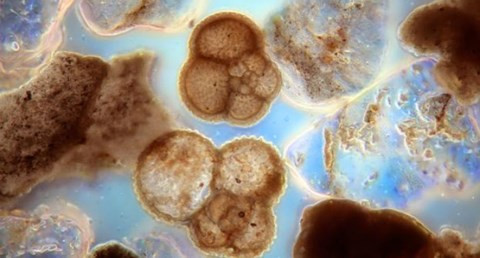 Khe vuc Mariana, noi sau nhat dai duong co dieu gi huyen bi?-Hinh-5