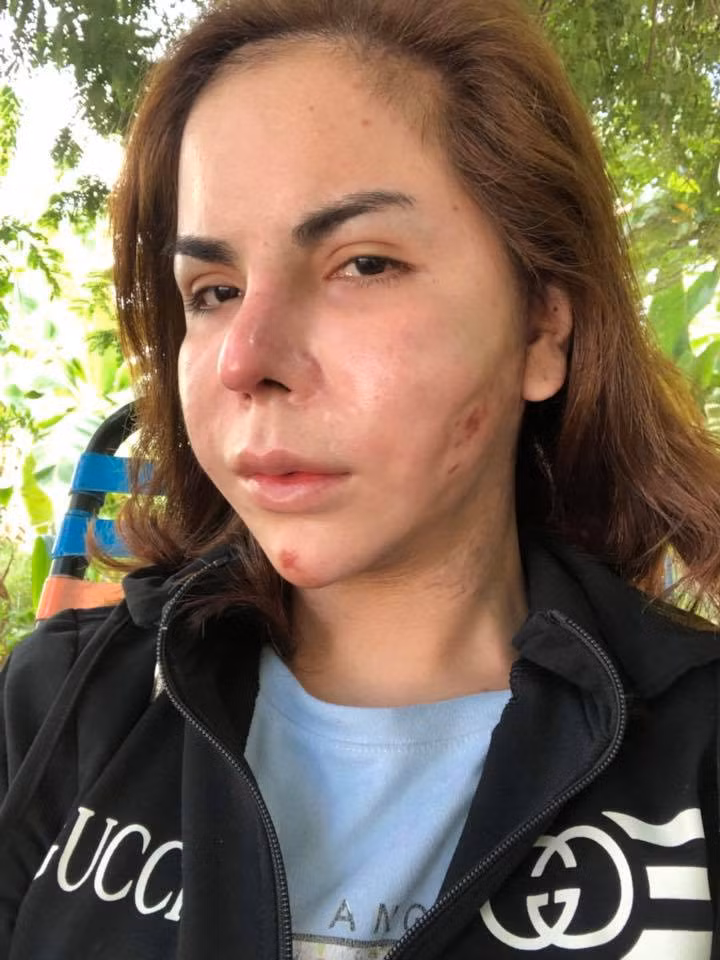 "Người đẹp" chia sẻ trên trang cá nhân: "Liệu có ai còn nhận ra đây là Linda của vài tháng trước không ạ? Sự việc đã xảy ra như vậy rồi thì mình chẳng quan trọng gì đến sĩ diện và sắc đẹp nữa, nên thôi cứ chấp nhận và đối đầu với nó xem như một bài học để đời.