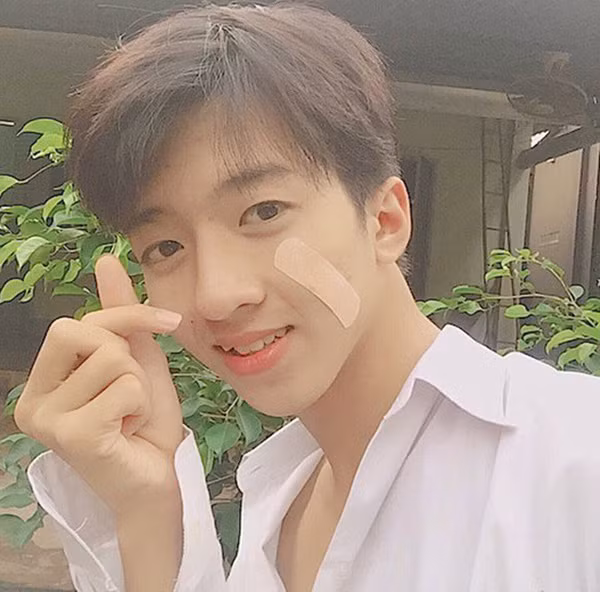 Gần đây, dân mạng được phen sục sôi vì ' hot boy băng dính'. Bên cạnh tấm ảnh chuẩn Hàn Quốc với nước da trắng hồng, đôi mắt một mí cùng đôi môi đỏ mọng, cậu bạn hot boy này còn khiến dân mạng cười ngả nghiêng vì phong cách kì quặc - dán băng urgo lên mặt. Tuy nhiên, vẻ điển trai của cậu chàng này thì không ai có thể phủ nhận được. Ngay sau đó, danh tính của cậu bạn điển trai này được tìm thấy. Được biết, 'chàng trai băng dính' này có tên Nguyễn Tuấn Trường (sinh năm 2001, sinh sống tại Bình Dương).