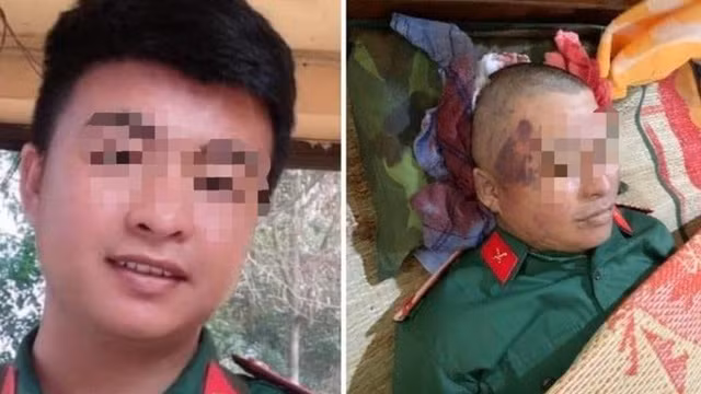 Tin nong 7/1: Danh tinh 3 doi tuong danh 1 quan nhan tu vong