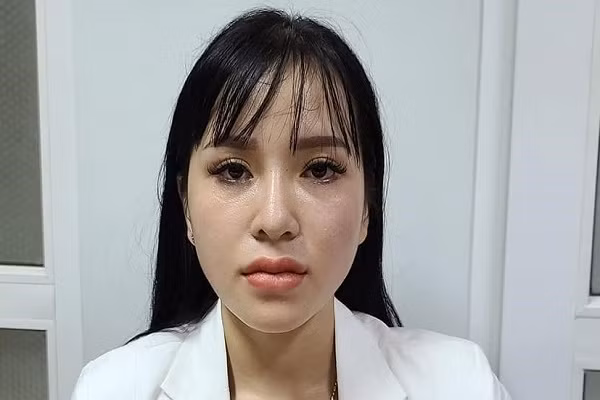 Hot girl cam dau duong day mua ban 2.800 vien thuoc lac sa luoi