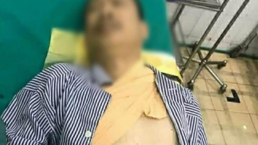  Lời qua tiếng lại, nghịch tử chém vào cổ bố đẻ: Chiều 18/7, khi đi làm về, Nguyễn Vũ Hoàng M. (17 tuổi, trú tại phường Quang Hanh, TP Cẩm Phả, Quảng Ninh) và bố là ông N.V.D. có xích mích với nhau. Đến tối cùng ngày, M. đã dùng dao chém vào vùng cổ bố đẻ, khiến ông D. mất nhiều máu và được người thân đưa đi cấp cứu tại bệnh viện đa khoa tỉnh Quảng Ninh. Gây án xong, M. cố thủ trong nhà, cho đến 21 giờ thì bị lực lượng chức năng bắt giữ. Tại thời điểm bị bắt giữ, M. có biểu hiện không bình thường về tâm lý. 