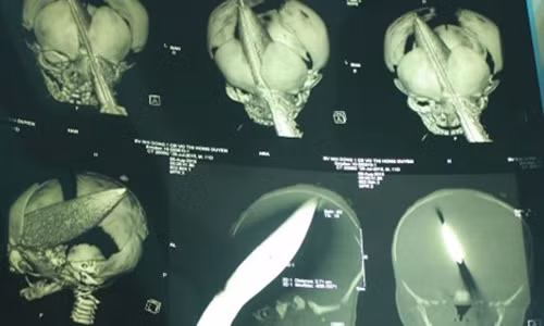 Be trai bi dam xuyen dau: Da bat duoc nghi pham