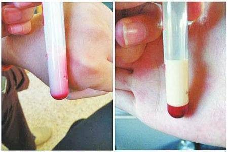 Me bau lay mau kham thai ra toan mau trang duc, bac si tai mat