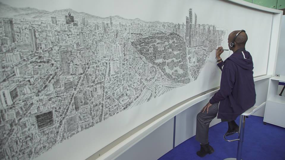 Tro thanh thien tai vi mac benh hiem nhat the gioi-Hinh-4